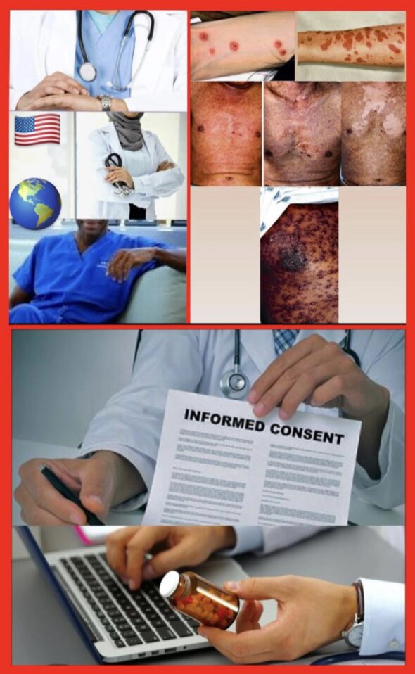 BEWARE!!!Changes in your skin appearance may sometimes signal changes in your skin health or overall health. DO NOT use fresh milk to help restore your skin barrier to either treat damage skin from bleaching or if you are prone to severe skin conditions: bacterial acne, Dermatitis, (skin inflammation, characterised by itchiness, redness and a rash) Psoriasis. Thick, red patches of skin covered with white or silvery scales are signs of psoriasis. Hives, using raw milk on your face when suffering from the aforementioned skin issues is probably not a good idea because raw milk will deposit bacteria on to your skin. The same bacteria that may prove cleansing and rejuvenating a healthy skin, may clash with a skin facing a pathological issue. You MUST check in a health clinic instead and seek advice from a Board-certified Dermatologist. The Bridge MAG. Image