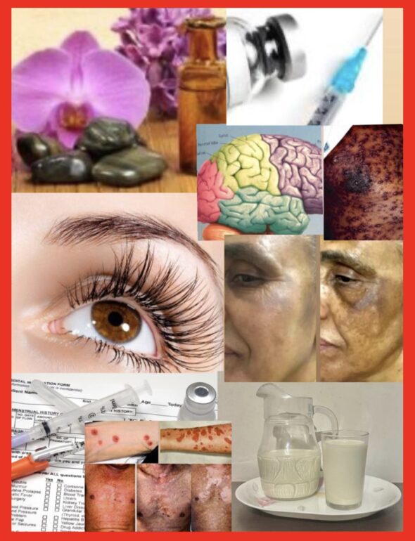 The Ugly Cost of Beauty: when some skincare products and routine become the silent killer of the modern era.The Deadly Cost of Beauty: most skincare routines continue to kill billions in a silence manner as humans are desperate to please others' gaze. The Bridge Magazine persistently raises awareness over brain damage due the use of skin lightening skincare, overnight skin bleaching intravenous (IV) skin whitening drips, some toxic tanning cream, tanning beds. A Proper skin care routine is key to maintaining a beautiful, velvety and healthy skin as in a basic daily shower with a non-abrasive soaps or shower gels. The Bridge MAG. Image